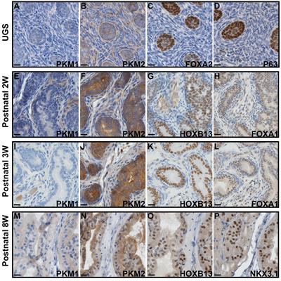 The expression of PKM1 and PKM2 in developing, benign, and cancerous prostatic tissues